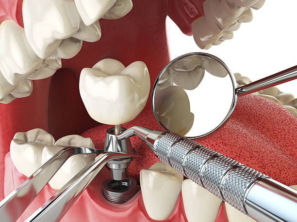 Best Pediatric Emergency Dentist in Konterra, MD